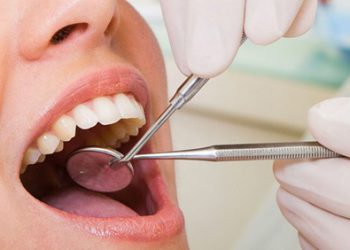 Răng giả cố định