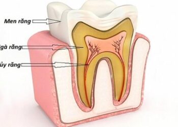 Điều trị viêm tủy răng như thế nào?