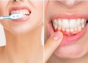 Vì sao bạn không nên đánh răng ngay sau khi bị nôn mửa?